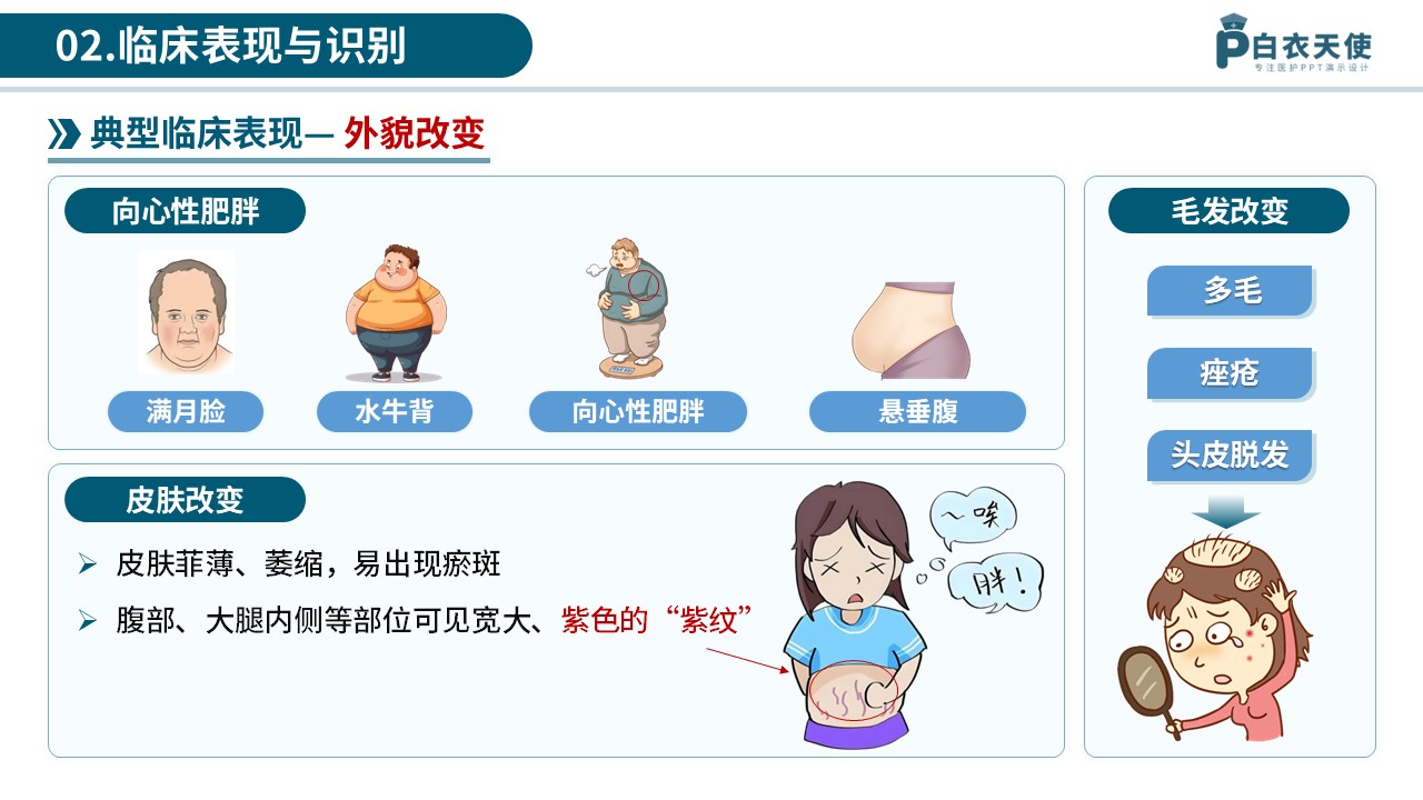 77-库欣综合征医护科普第5页预览