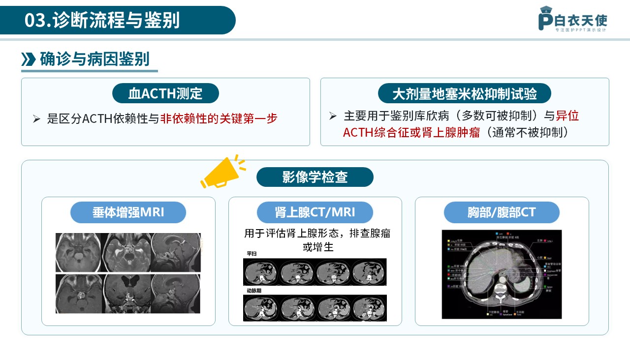 77-库欣综合征医护科普第8页预览
