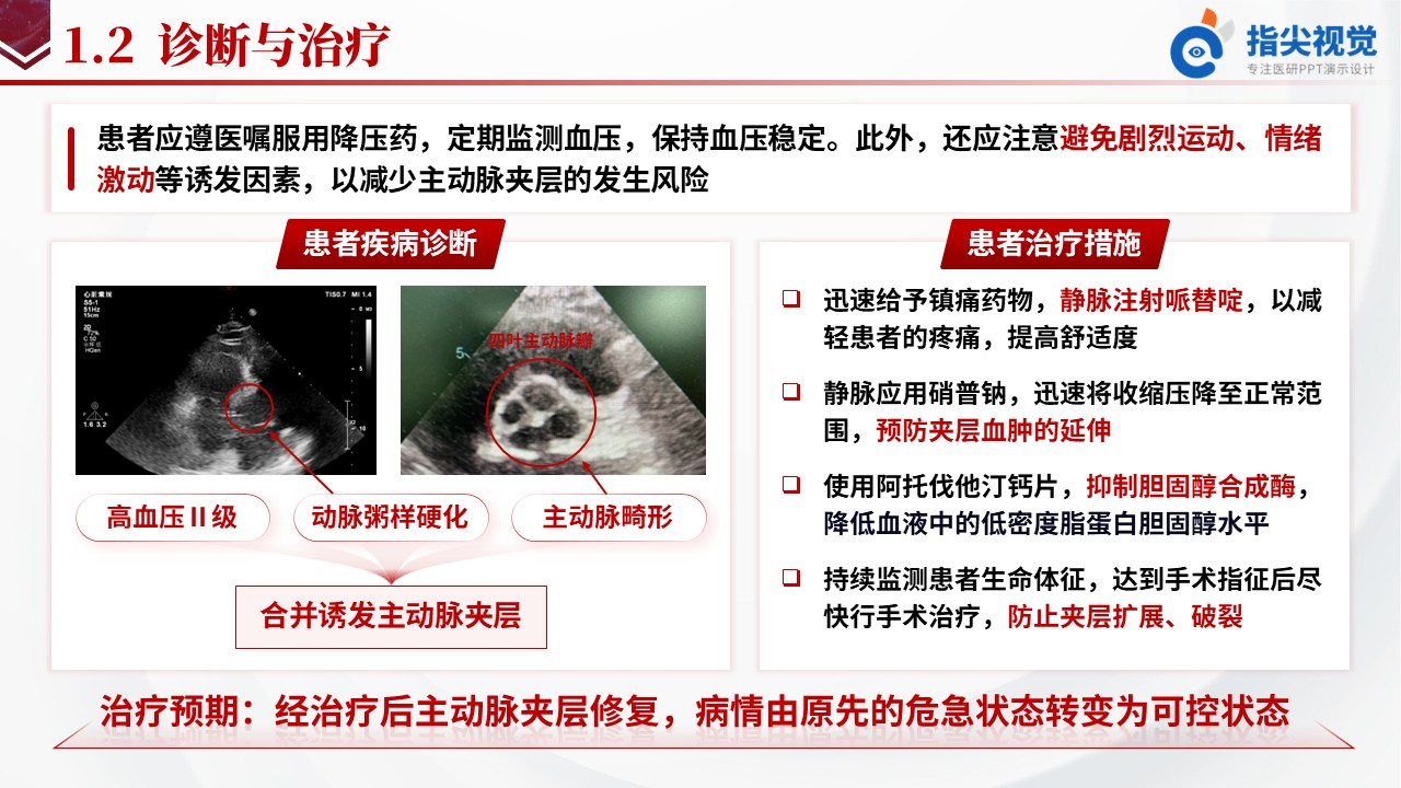 101期-主动脉夹层护理个案(红色)第4页预览