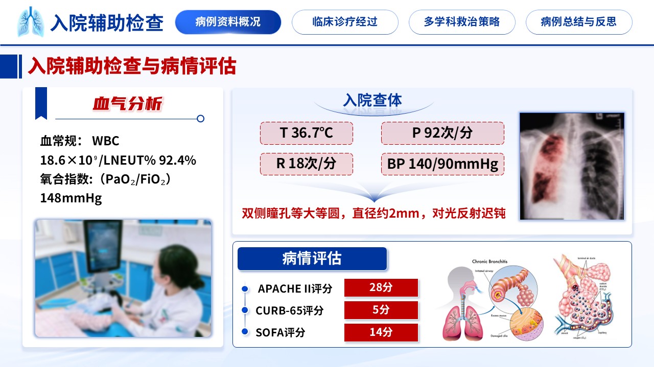 341期-护理个案-一例重症肺炎合并多器官功能衰竭的临床诊疗复盘第4页预览