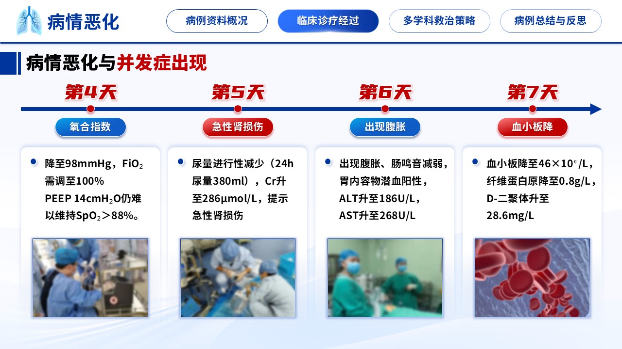 341期-护理个案-一例重症肺炎合并多器官功能衰竭的临床诊疗复盘第8页预览