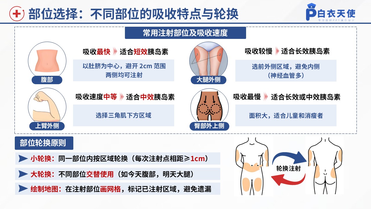 51-胰岛素规范注射健康宣教第6页预览