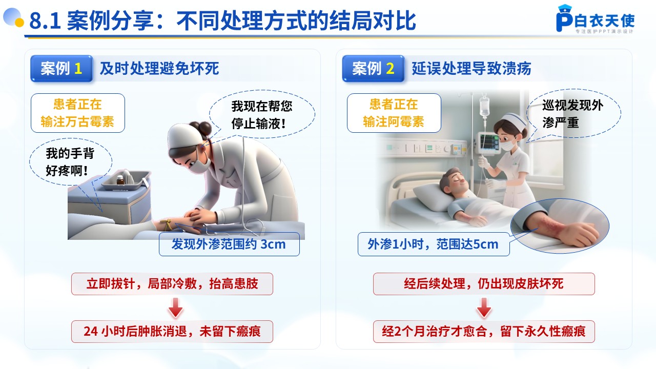 54-药物的外渗处理和预防健康宣教第13页预览