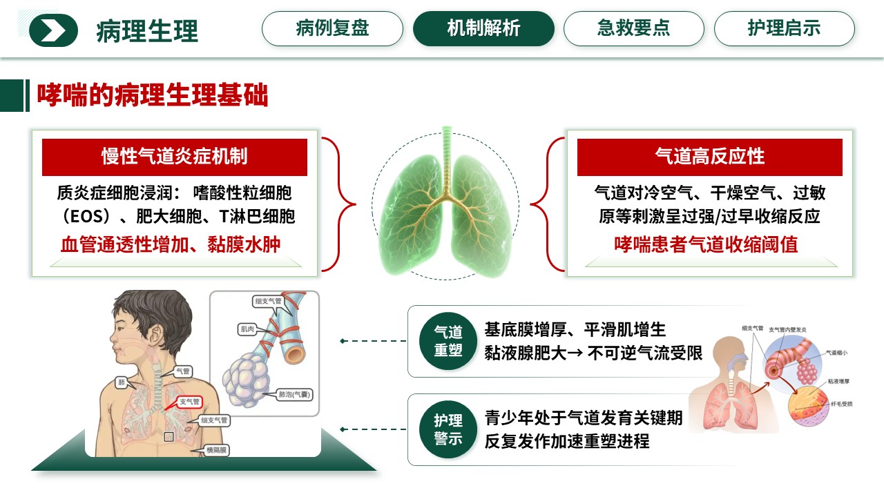 351期-护理说课-被“运动”扼住的呼吸——青少年运动性过敏与哮喘危象的急救护理第7页预览