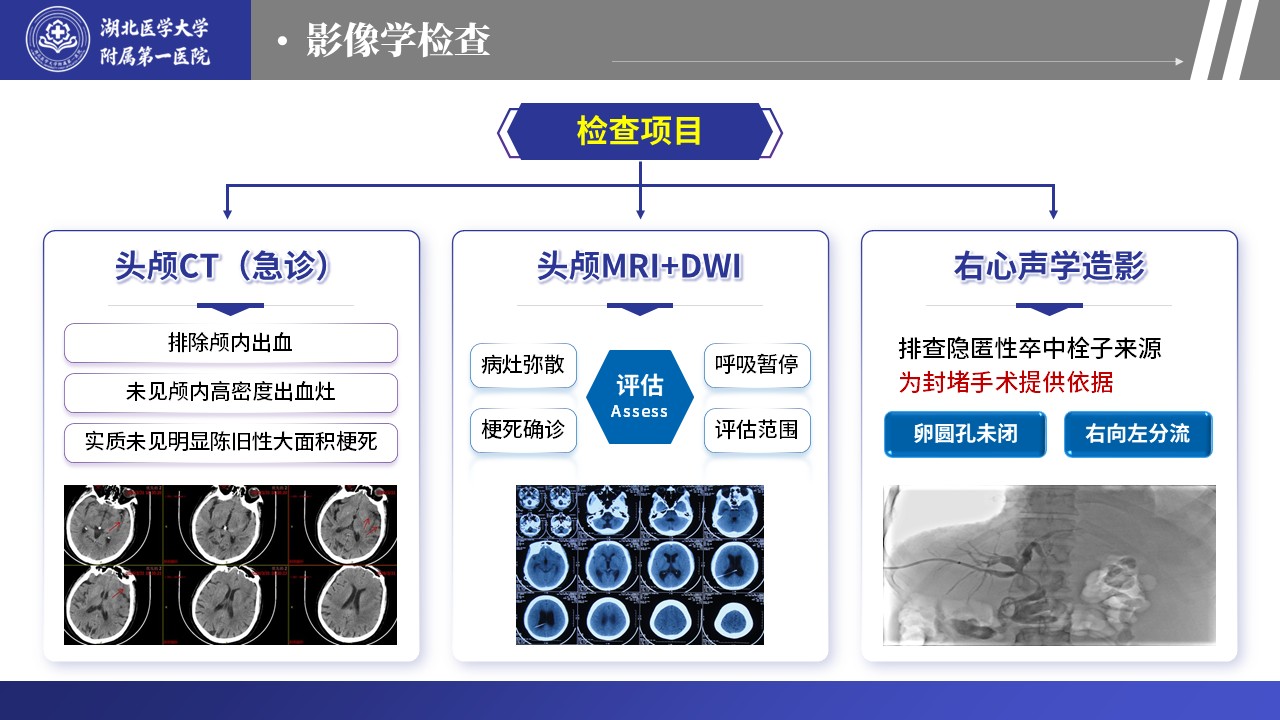 465期-护理个案-基于循证理念的急性脑卒中合并 PFO 患者护理第6页预览