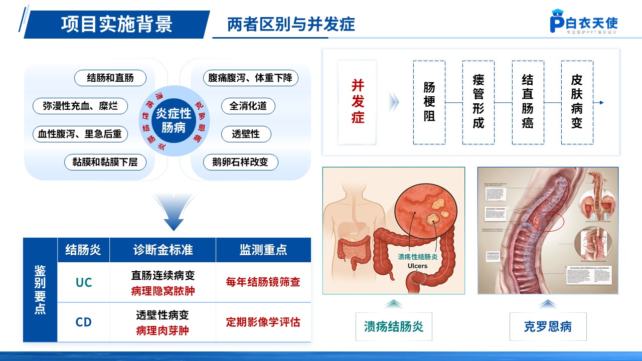 159期-炎症性肠病优质护理第4页预览