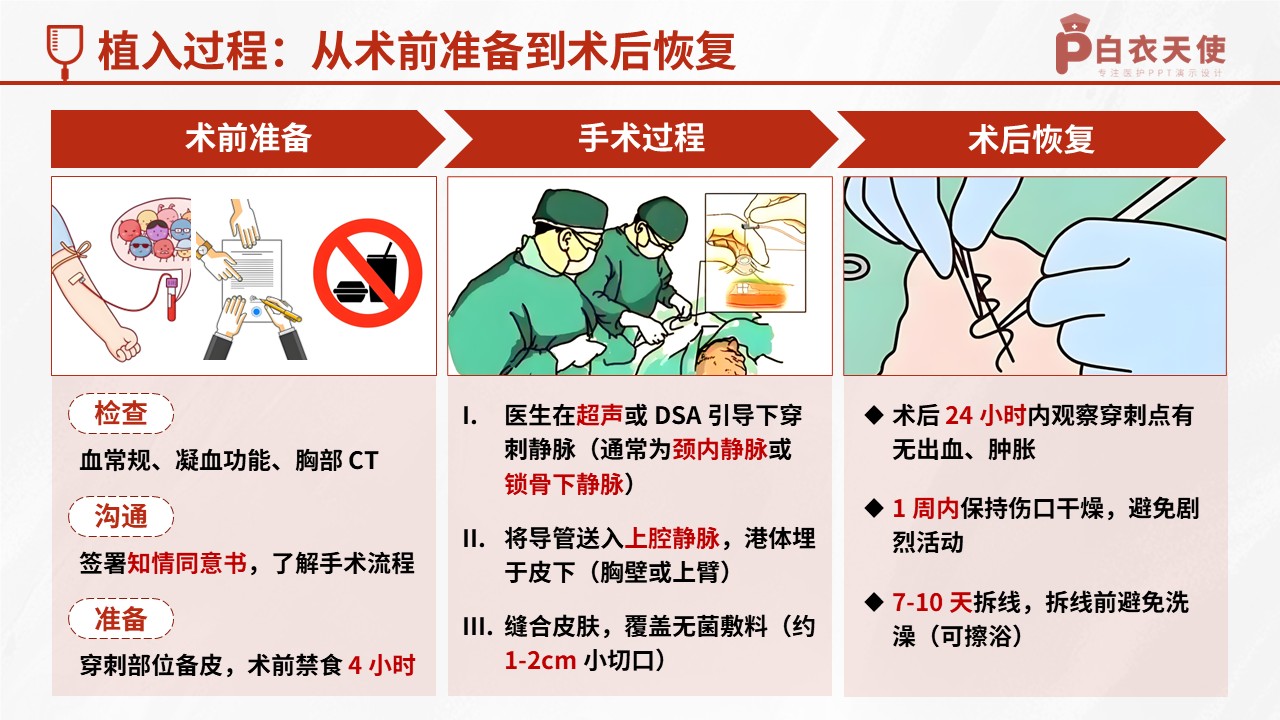 52-输液港健康宣教第5页预览